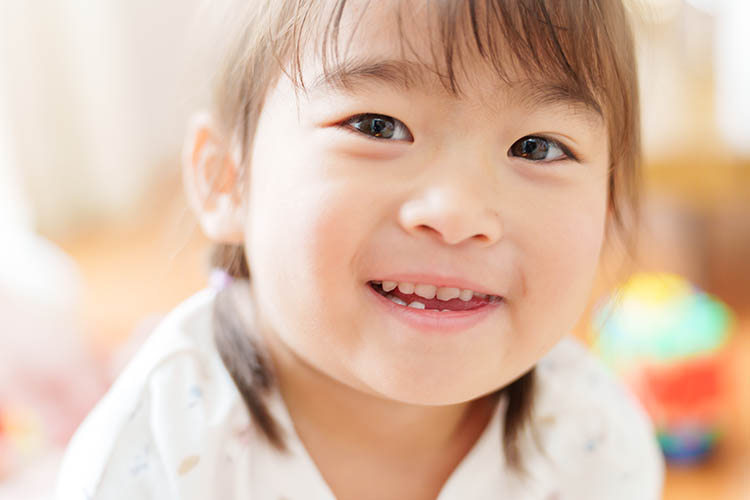 東京都の子どもの歯並び（小児矯正）専門医院、キッズデンタルの側方交叉咬合（あごの横ずれ）の矯正治療
